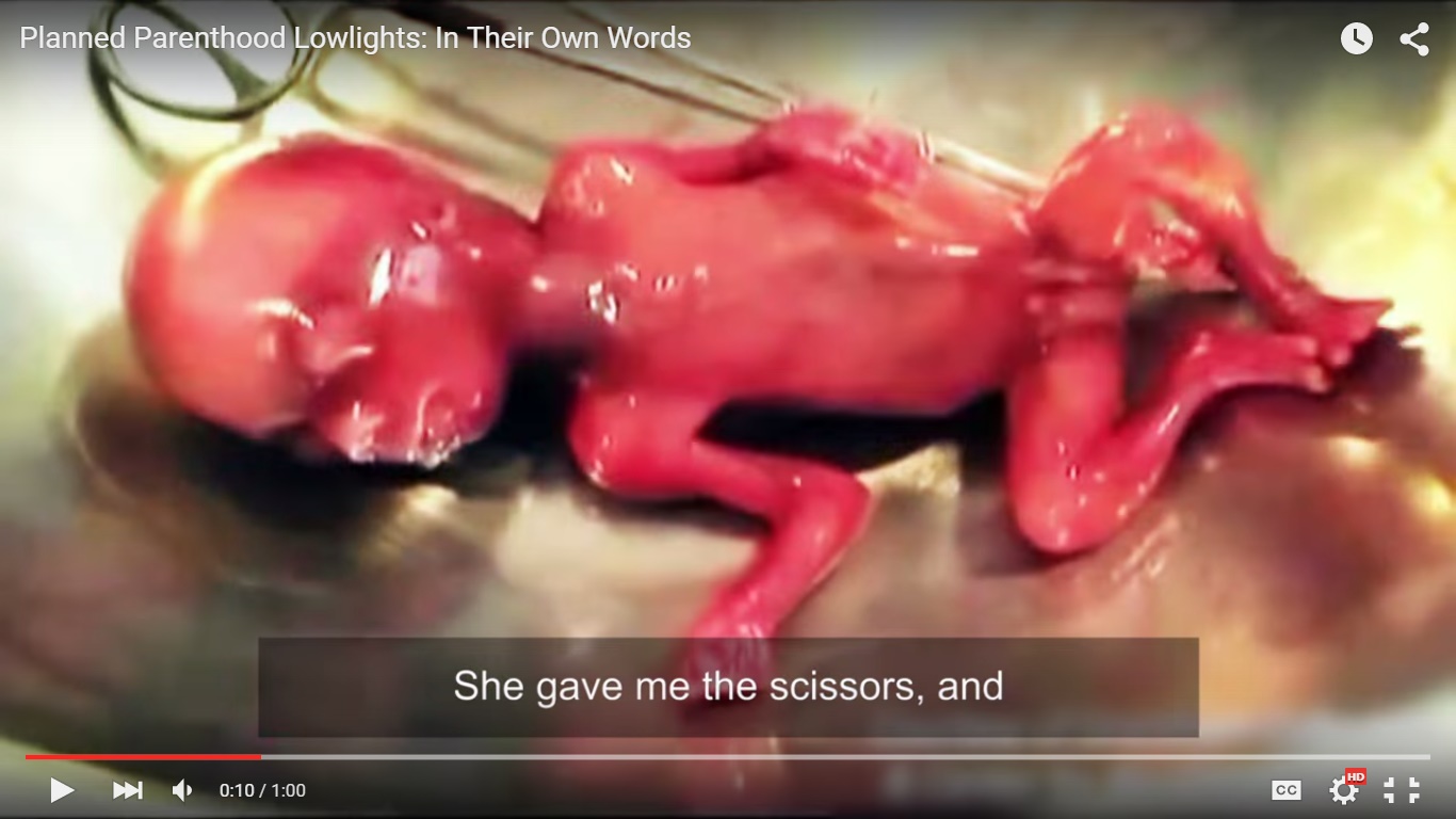 Photo of Planned Parenthood Lowlights: In Their Own Words