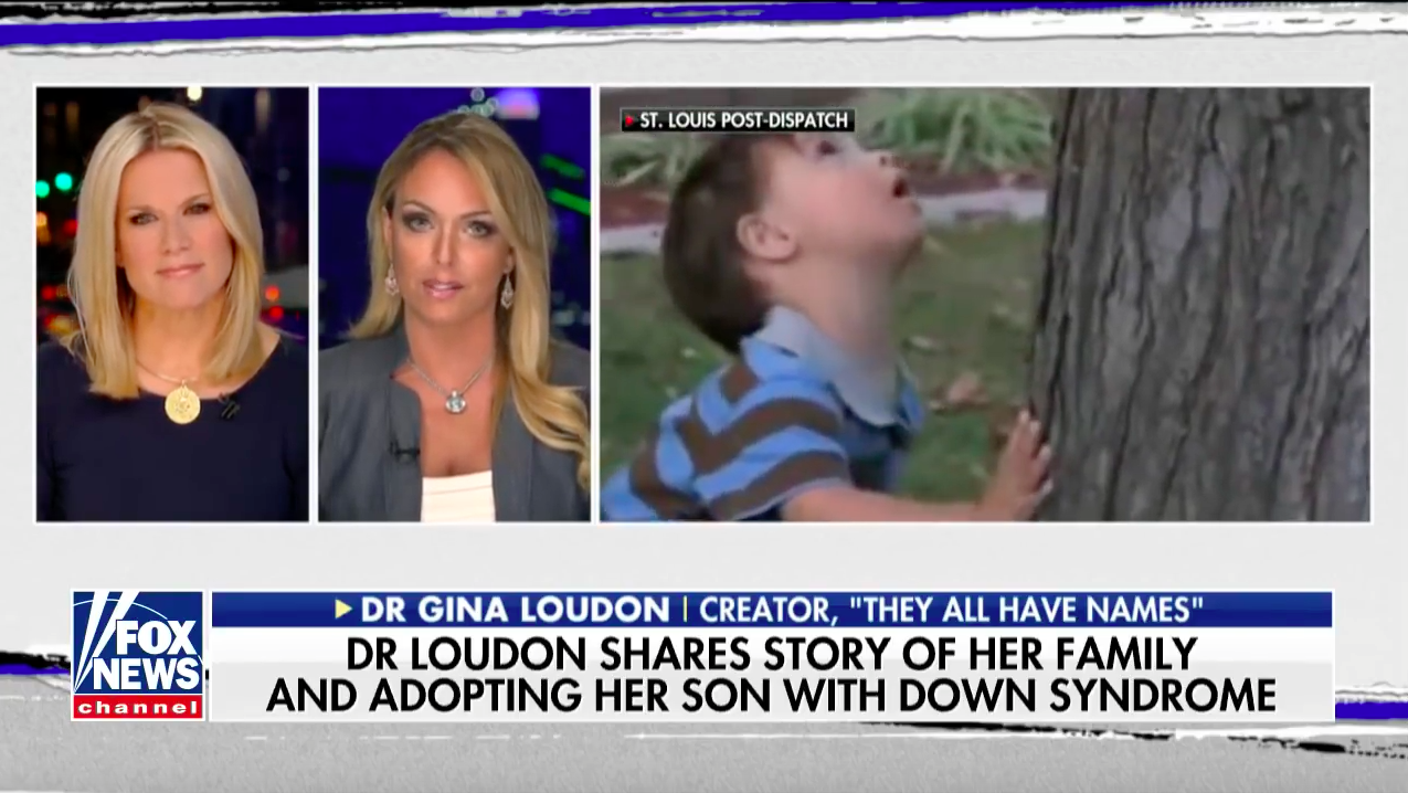 Photo of Dr. Loudon on the debate over Down Syndrome and abortion (Fox News)